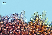 Leucoagaricus crystallifer cheilo