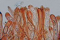 Neournula pouchetii parafisi
