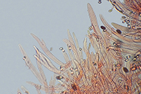 Leucoagaricus crystallifer pileipellis