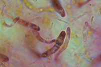 Russula parodorata pileocistidi